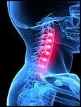 交通事故で受けたむち打ち症には背骨矯正が有効です